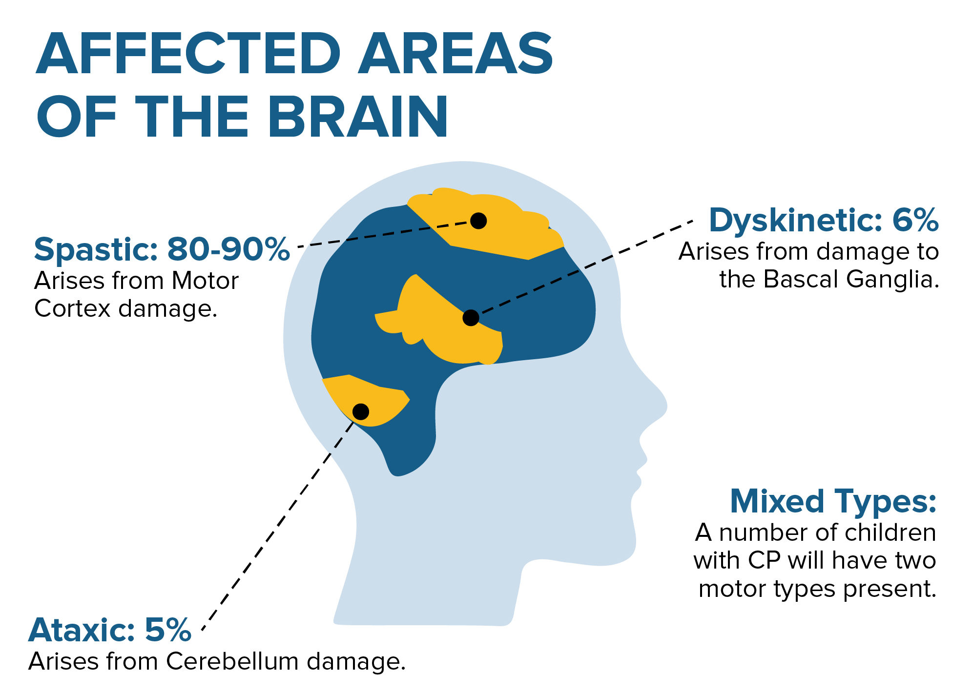 types of cerebral palsy brain